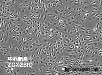 https://img.medsci.cn/8eee53bbc4cb7a98de615e72115896bc4e27fda5cbb764dbd67d9d641c2bb46a.png