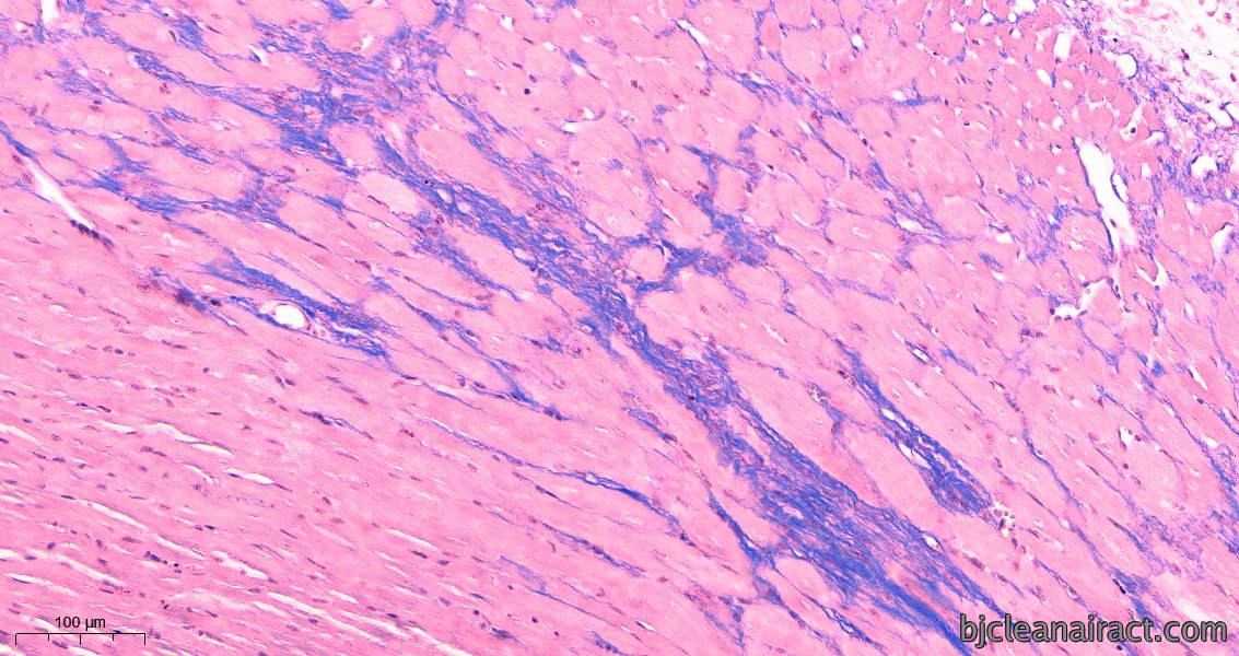 https://img.medsci.cn/09f7f9b396aaea8c5a2398de56f920980d508f8e7313325b130eae0a6c633bd4.png